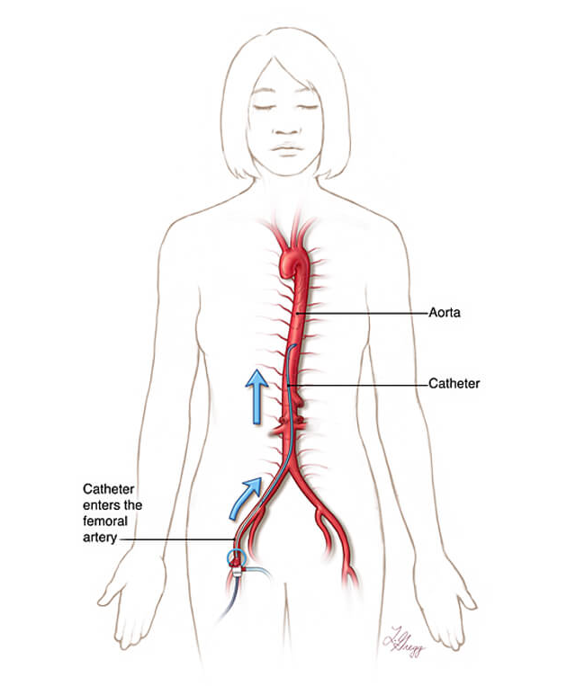pathway to spine diagram