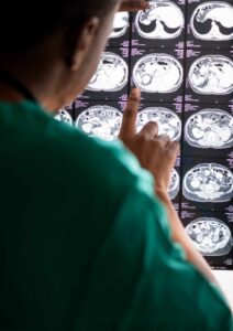 Brain Hemorrhage Surgery in Patparganj
